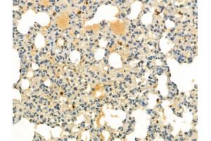 ABIN6255286 and ABIN6267647 at 1/100 staining Rat lung tissue by IHC-P.