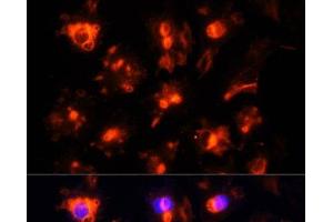 Immunofluorescence analysis of HUVEC cells using CD31 Polyclonal Antibody at dilution of 1:100. (CD31 antibody)