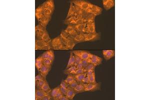 Immunofluorescence analysis of U2OS cells using PFKL antibody (ABIN7269308) at dilution of 1:100. (PFKL antibody  (AA 700-780))