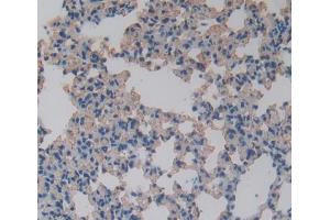 IHC-P analysis of Mouse Tissue, with DAB staining. (FABP5 antibody  (AA 2-135))