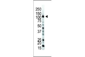 The anti-UBE1 Pab (ABIN388844 and ABIN2839150) is used in Western blot to detect UBE1 in HL-60 cell lysate. (E1 Ubiquitin (AA 1026-1058), (C-Term) antibody)