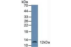 Detection of DEFa1 in Human Liver Tissue using Polyclonal Antibody to Defensin Alpha 1, Neutrophil (DEFa1) (alpha Defensin 1 antibody  (AA 20-94))