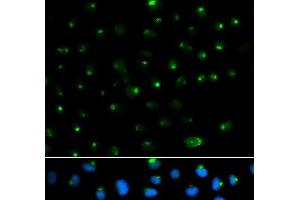 Immunofluorescence analysis of MCF-7 cells using PSAP Polyclonal Antibody (Prosaposin antibody)