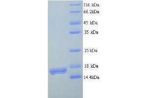 SDS-PAGE (SDS) image for Triggering Receptor Expressed On Myeloid Cells 5 (TREM5) (AA 18-151) protein (His tag) (ABIN5713332) (CD300LB Protein (AA 18-151) (His tag))