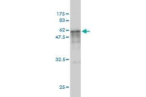 Western Blot detection against Immunogen (67. (CASQ2 antibody  (AA 20-399))