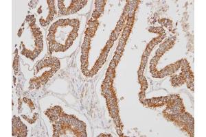 Immunohistochemistry (IHC) image for anti-Hydroxysteroid (17-Beta) Dehydrogenase 10 (HSD17B10) (C-Term) antibody (ABIN2854703)