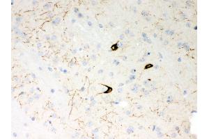 Anti- Neuropeptide Y Picoband antibody,IHC(P) IHC(P): Mouse Brain Tissue (NPY antibody  (Middle Region))