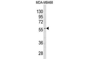 Western blot analysis of CYP4B1 Antibody (Center) in MDA-MB468 cell line lysates (35ug/lane). (CYP4B1 antibody  (Middle Region))