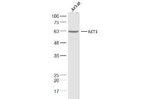 Jurkat lysates probed with NET1 Polyclonal Antibody, Unconjugated  at 1:1000 dilution and 4˚C overnight incubation. (NET1 antibody  (AA 501-596))