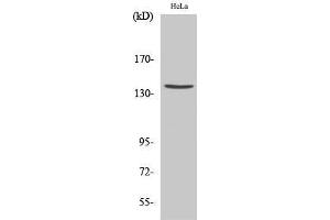 Western Blot (WB) analysis of specific cells using Cleaved-Spectrin alpha II (D1185) Polyclonal Antibody. (SPTAN1 antibody  (Asp1185, cleaved))