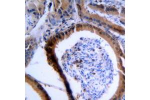 Immunohistochemical analysis of VASP staining in human tonsil formalin fixed paraffin embedded tissue section.