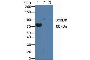 Western blot analysis of (1) Rat Blood Cells, (2) Human JAR Cells and (3) Human Placenta Tissue. (CSF3R antibody  (AA 26-138))