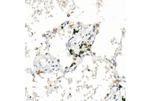 Immunohistochemistry of paraffin-embedded human lung using  Rabbit mAb (ABIN7265424) at dilution of 1:1000 (40x lens).