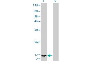 Western Blot analysis of FABP1 expression in transfected 293T cell line by FABP1 monoclonal antibody (M02A), clone 5F7. (FABP1 antibody  (AA 1-127))