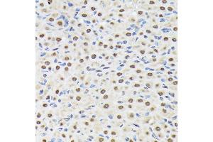 Immunohistochemistry (IHC) image for anti-Matrin 3 (MATR3) antibody (ABIN7268414)