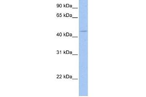WB Suggested Anti-SOX8 Antibody Titration:  0. (SOX8 antibody  (C-Term))