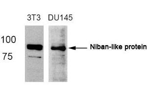 Western Blotting (WB) image for anti-Family with Sequence Similarity 129, Member B (FAM129B) (AA 710-714) antibody (ABIN363056) (MEG3 antibody  (AA 710-714))