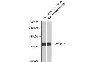 Western blot analysis of extracts of various cell lines, using MYBPC2 antibody (ABIN6129608, ABIN6144218, ABIN6144220 and ABIN6222676) at 1:1000 dilution. (MYBPC2 antibody  (AA 912-1141))
