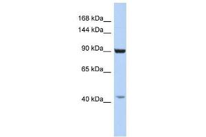 GRIP1 antibody used at 2. (GRIP1 antibody  (C-Term))