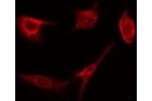 ABIN6274661 staining HepG2 by IF/ICC. (CYP4Z1 antibody)