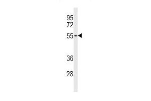 Western blot analysis of ACCN1 Antibody (Center) (ABIN653161 and ABIN2842729) in NCI- cell line lysates (35 μg/lane).