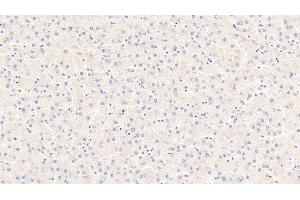 Detection of PCK2 in Human Liver Tissue using Polyclonal Antibody to Phosphoenolpyruvate Carboxykinase 2, Mitochondrial (PCK2) (PEPCK antibody  (AA 33-198))