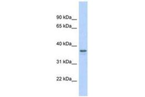 Image no. 1 for anti-Glyceraldehyde-3-Phosphate Dehydrogenase (GAPDH) (AA 107-156) antibody (ABIN6742094) (GAPDH antibody  (AA 107-156))