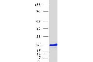 Validation with Western Blot (ITPA Protein (Transcript Variant 1) (Myc-DYKDDDDK Tag))