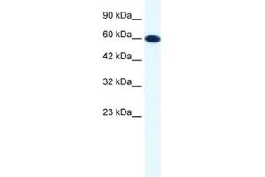 Western Blotting (WB) image for anti-DEAD (Asp-Glu-Ala-Asp) Box Polypeptide 6 (DDX6) antibody (ABIN2461341) (DDX6 antibody)