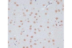 Immunohistochemistry (Paraffin-embedded Sections) (IHC (p)) image for anti-Mitogen-Activated Protein Kinase 3 (MAPK3) (pThr185), (pThr202), (pTyr187), (pTyr204) antibody (ABIN7265214)