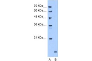 Western Blotting (WB) image for anti-Crystallin, alpha B (CRYAB) antibody (ABIN2463152) (CRYAB antibody)