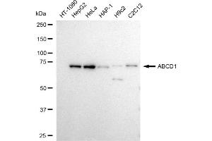 Western blotting analysis using ABCD1 antibody (ABIN7797686). (Recombinant ABCD1 antibody)