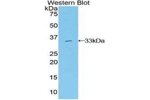Western Blotting (WB) image for anti-Growth Factor Receptor-Bound Protein 7 (GRB7) (AA 66-327) antibody (ABIN1859067) (GRB7 antibody  (AA 66-327))