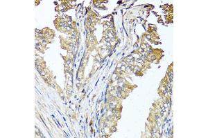 Immunohistochemistry of paraffin-embedded human prostate using STK3 antibody. (STK3 antibody)