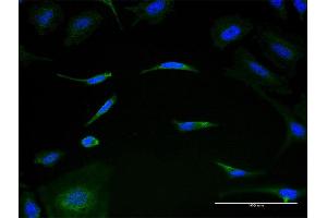 Immunofluorescence of monoclonal antibody to MRPL1 on HeLa cell. (MRPL1 antibody  (AA 1-303))