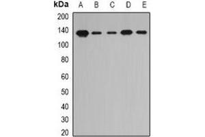 Western blot analysis of PITRM1 expression in A549 (A), MCF7 (B), mouse liver (C), mouse kidney (D), rat heart (E) whole cell lysates. (PITRM1 antibody)
