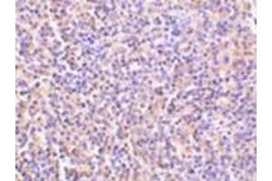 Immunohistochemistry of TCCR in human spleen tissue with this product at 5 μg/ml. (IL27 Receptor alpha antibody  (C-Term))