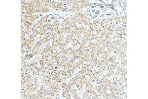 IHC analysis of NOB1 using anti-NOB1 antibody (ABIN7599344). (NOB1 antibody  (AA 1-389))