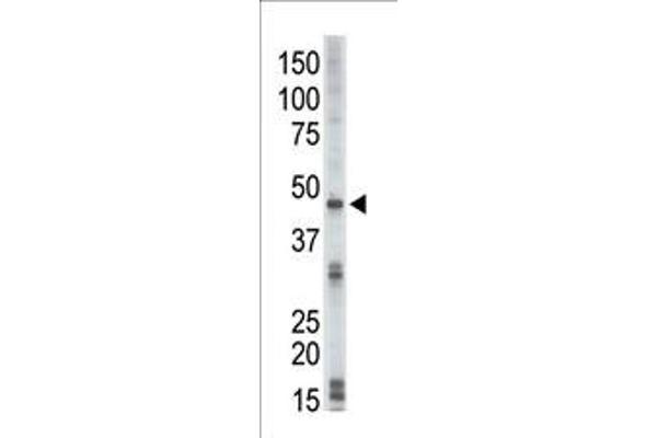 DRAK2 antibody  (C-Term)