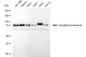 anti-Diacylglycerol Kinase, beta 90kDa (DGKB) antibody