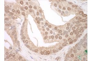 Immunohistochemistry (IHC) image for anti-Tuftelin Interacting Protein 11 (TFIP11) (AA 1-50) antibody (ABIN7448831)