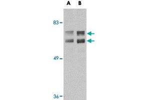 Western blot analysis of JPH2 in mouse brain tissue lysate with JPH2 polyclonal antibody  at (A) 1 and (B) 2 ug/mL . (Junctophilin 2 antibody  (C-Term))