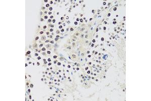 Immunohistochemistry of paraffin-embedded mouse testis using Cyclin E2 antibody (ABIN1679046, ABIN3018761, ABIN3018762 and ABIN6220571) at dilution of 1:100 (40x lens). (Cyclin E2 antibody  (C-Term))