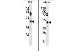 Image no. 1 for anti-Heterogeneous Nuclear Ribonucleoprotein K (HNRNPK) (N-Term) antibody (ABIN358037)