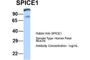 Host: Rabbit  Target Name: SPICE1  Sample Tissue: Human Fetal Muscle  Antibody Dilution: 1. (SPICE1 antibody  (Middle Region))