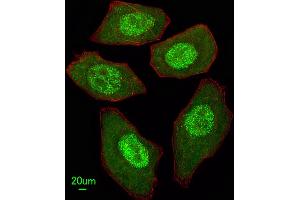 Immunofluorescent analysis of  cells, using FANCC Antibody (C-term) (ABIN653475 and ABIN2842896). (FANCC antibody  (C-Term))