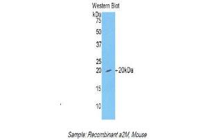 Western Blotting (WB) image for anti-alpha-2-Macroglobulin (A2M) (AA 1053-1214) antibody (ABIN1857846) (alpha 2 Macroglobulin antibody  (AA 1053-1214))