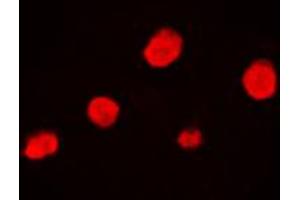 Immunofluorescent analysis of EZH1 staining in HeLa cells. (EZH1 antibody  (Center))