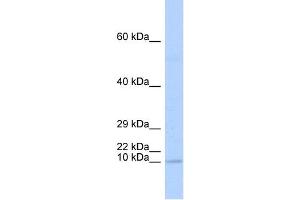 WB Suggested Anti-TAL2 Antibody Titration:  0. (TAL2 antibody  (N-Term))