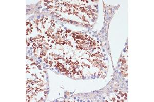 Immunohistochemistry of paraffin-embedded mouse testis using PKCδ antibody (ABIN6128464, ABIN6146203, ABIN6146204 and ABIN6213859) at dilution of 1:100 (40x lens).